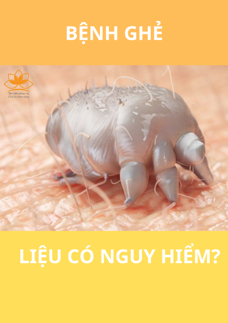 BỆNH GHẺ